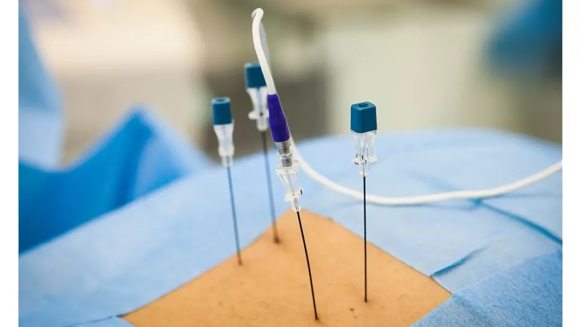 Radiofrequency denervation or facet denervation?